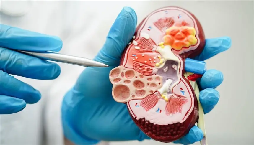 مرض مزمن يتقدم إلى قائمة أسباب الوفيات العشرة الأوائل عالميًا