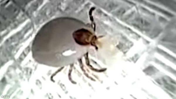 حشرة دخلت في أذن مريض.. وخرجت حية بعملية جراحية نادرة