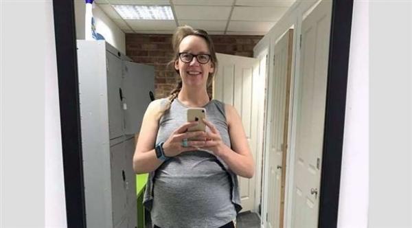 تظهر وكأنها حامل بسبب حالة صحية نادرة