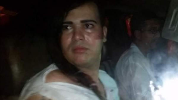 تطورات جديدة في قضية الاعتداء على شاذ جنسي في فاس