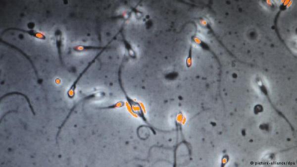 هل يسبب فيروس زيكا العقم لدى الرجال؟