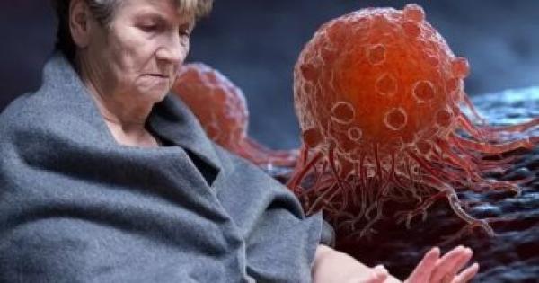 طبيب أورام يقدم نصائح ذهبية لتقليل خطر الإصابة بالسرطان