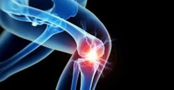 وصفة طبيعية تساعد على تخفيف آلام المفاصل