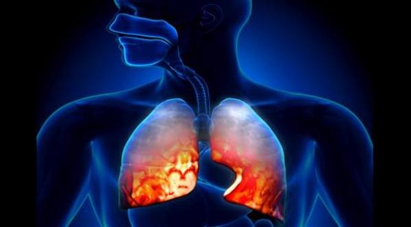 أكل البروتين يساعد على الشفاء من الالتهاب الرئوي