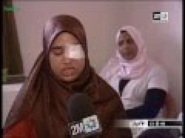 استادة تفقد عينها بعد الاعتداء عليها بششاوة