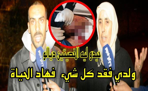 قمة الحكرة: السراح لـ"قناص" نافذ أصاب فلاحا برصاصتين على مستوى  جهازه التناسلي بعدما حاول منعه من الصيد بأرضه (فيديو)