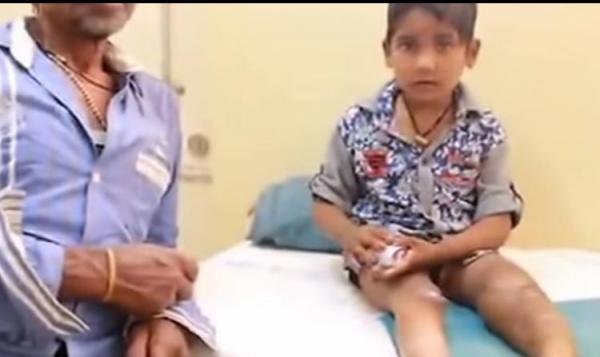 بالفيديو: طفلان يقضمان أصابعهما لعدم شعورهما بالألم