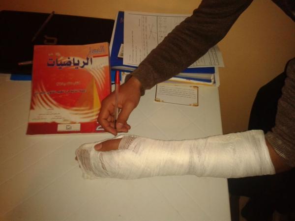 من جديد ، اعتداء على أستاذ إقليم أزيلال يتسبب في كسر يده اليسرى