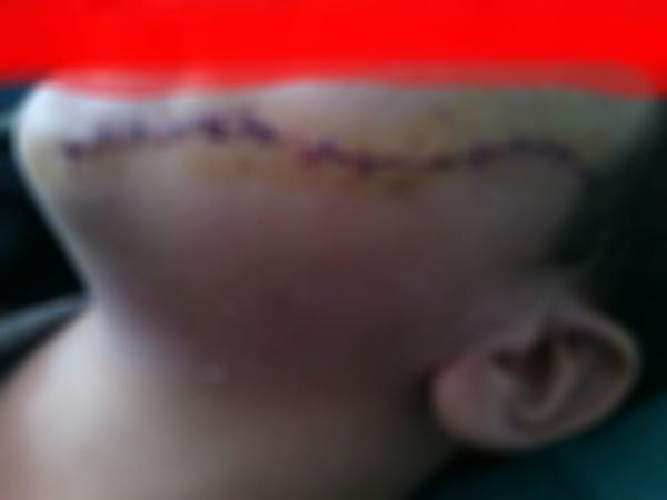 هذا ما قرره الوكيل العام للملك في حق التلميذ الذي "شرمل" وجه زميله داخل الفصل بشفرة حلاقة