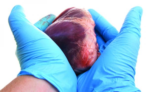 شرطي مطرود ينشر إعلانا يبحث من خلاله عن مشتر لكليته