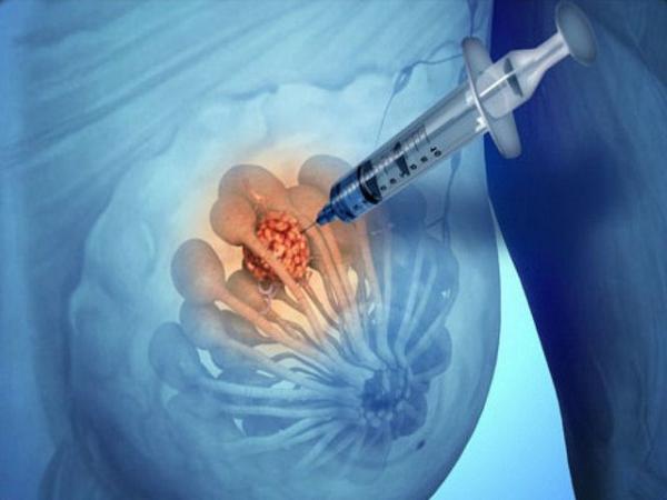 إجراء أول اختبار لدواء "ثوري" يتصدى لعدة أنواع من السرطان