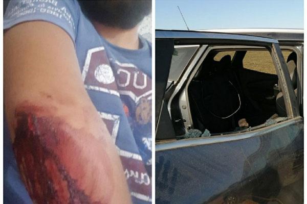 اعتداء خطير على مراقبي المكتب الوطني للكهرباء ضواحي الجديدة