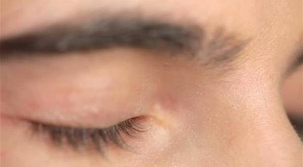 هذا ما يحصل في جسمك عندما تبكي