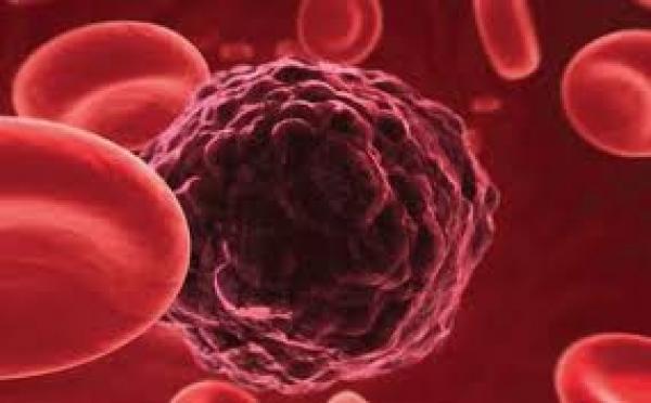 درجة الحرارة المرتفعة تُبطئ نمو الخلايا السرطانية