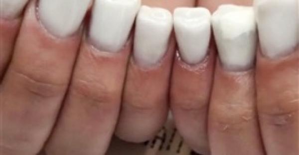 موضة جديدة للأظافر مستوحاة من الأسنان تثير ضجة (فيديو )