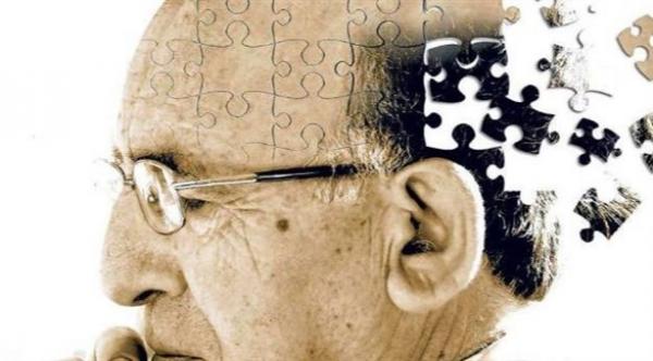 فحص للجينات يتنبّأ بموعد الإصابة بالزهايمر