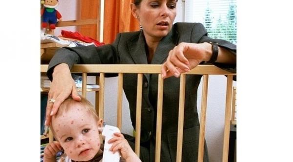 الحصبة قد تؤدي إلى الموت