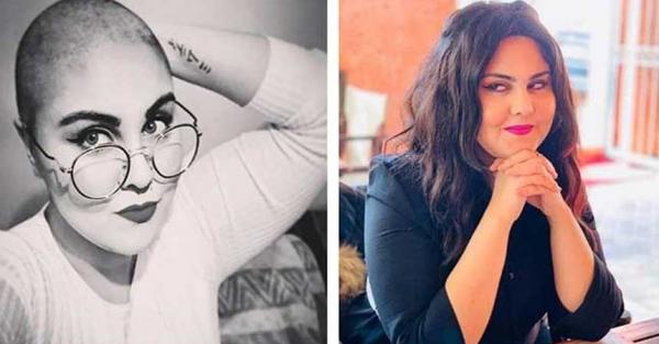 الفنانة "عبير العابد" تكشف عن معاناتها النفسية مع المرض النادر الذي أصابها