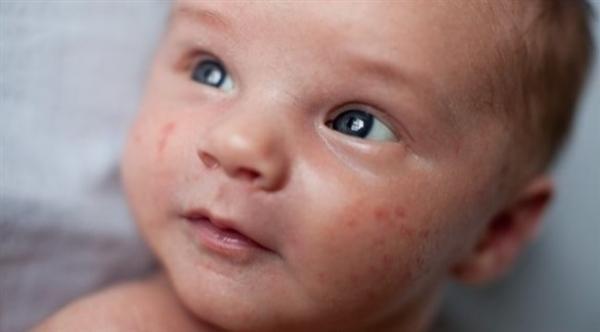 هل يسبب تسنين الطفل اضطرابات معوية؟