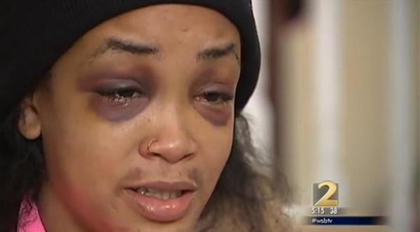 تلقت ضرباً مبرحاً على يد صديقاتها بسبب شطيرة هامبرغر