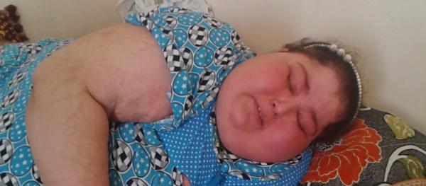 إلى فاعلي الخير ، إلى ذوي القلوب الرحيمة الطفلة فاطنة تناديكم‏