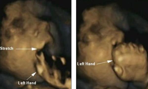 لمس الأجنة لوجوههم في مجموعة صور ثلاثية الأبعاد