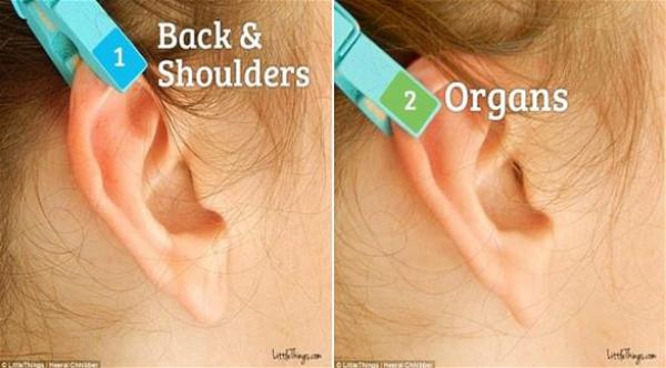 بالصور: هكذا تتخلص من الآلام باستخدام ملاقط الغسيل