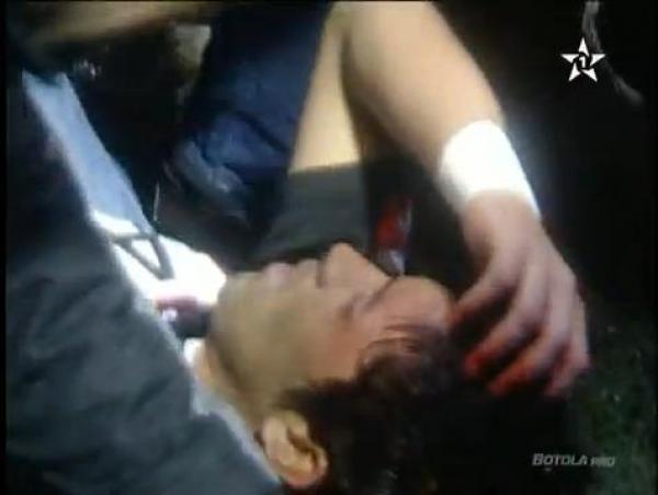 نقل  لاعب المغرب الفاسي برابح الى المستشفى