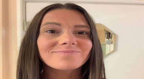 بعد سنوات طويلة من المعاناة .. امرأة تشفي نفسها من الأكزيما بطريقة غير متوقعة