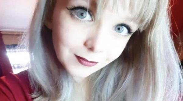 نجاح عملية جراحة رائدة في الحؤول دون انفصال رأس شابة بريطانية عن جسدها