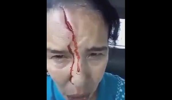 مؤلم و صادم ... شاهد السيدة التي شرملها مجرم خطير بجنوية !