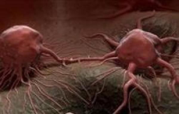 احذر:"غداء مجاني" للأورام السرطانية يسرّع نموها