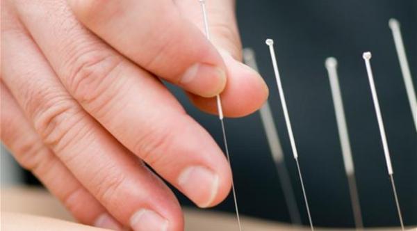 الوخز بالإبر الصينية يوقف الخرف في مرحلة مبكرة