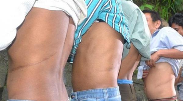 سكان قرية في نيبال يبيعون أعضاءهم لشراء المنازل