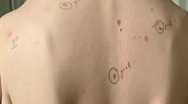 طبيب يكتب تشخيصه لحالة مريض على ظهره وصدره