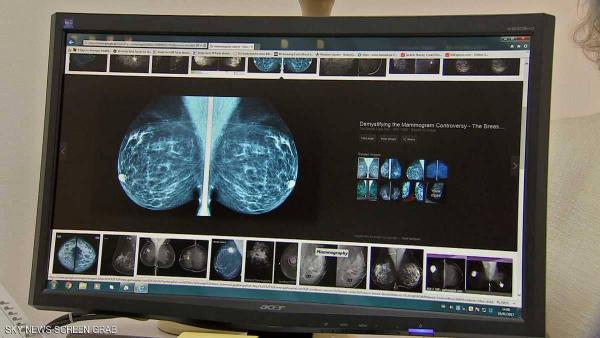 نتائج مبشرة تعد بأول انتصار ضد سرطان الثدي