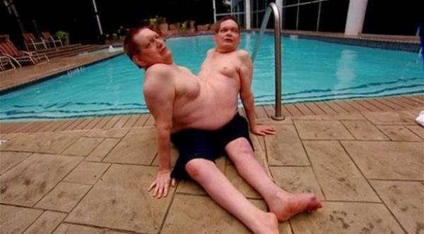 فيديو .. توأم أمريكي ملتصق يبلغ 62 عاماً