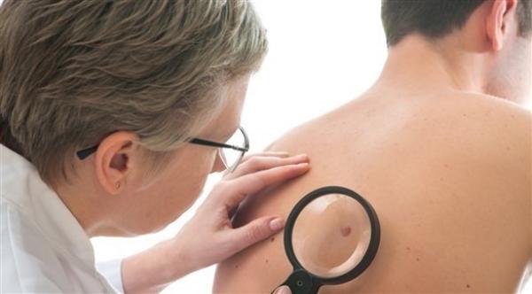 تعرّف على الأعراض المبكرة للسرطان