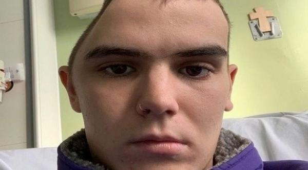 يستطيع العيش بنصف جمجمة بعد سقوطه من فوق سطح منزل