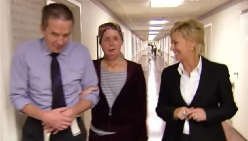 مزّق الشمبانزي وجهها..الضحية تكشف عن وجهها الجديد بعد 16 عاماً من أعقد عمليات الزرع في العالم