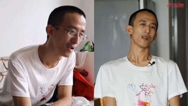 يتحول من طفل "معجزة" دخل الجامعة في سن العاشرة.... إلى عاطل عن العمل