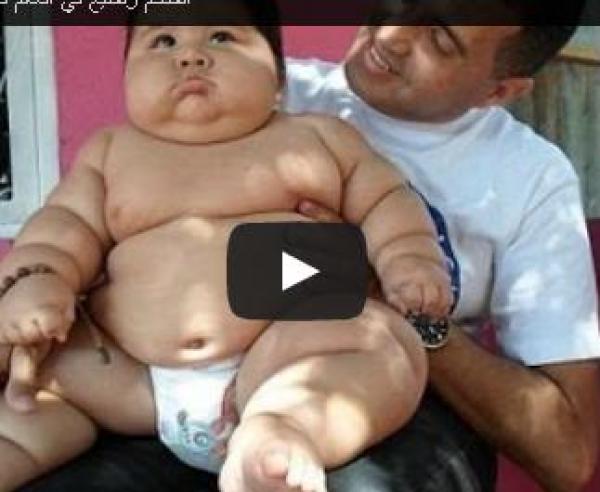 بالفيديو ... رضيع لم يكمل عامه الأول بوزن 20 كيلوجرام