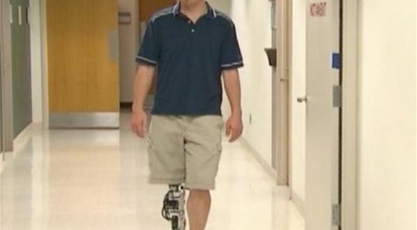 ساق اصطناعية تنقل لواضعها الإحساس بأنها طبيعية