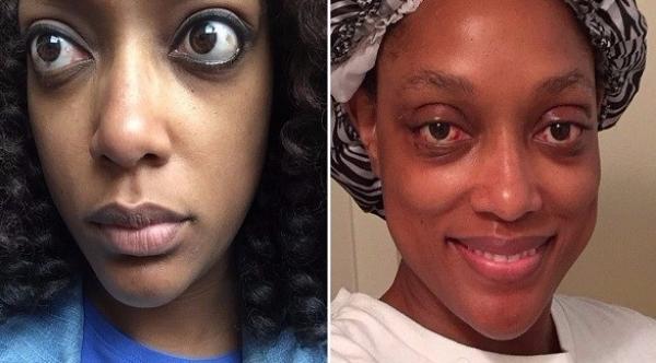 امرأة تخضع لعملية جراحية لإعادة عينيها إلى مكانهما