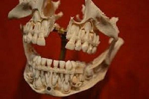 بالفيديو.. أسنان بقر وحمير وعبيد افارقة كانت في فم أول وأشهر رئيس أميركي