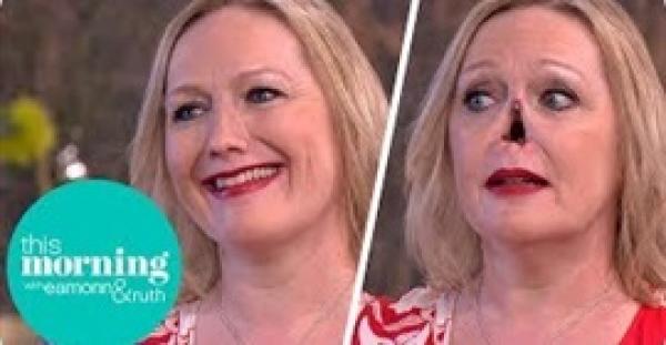 امرأة تزيل أنفها الاصطناعية على الهواء (فيديو)