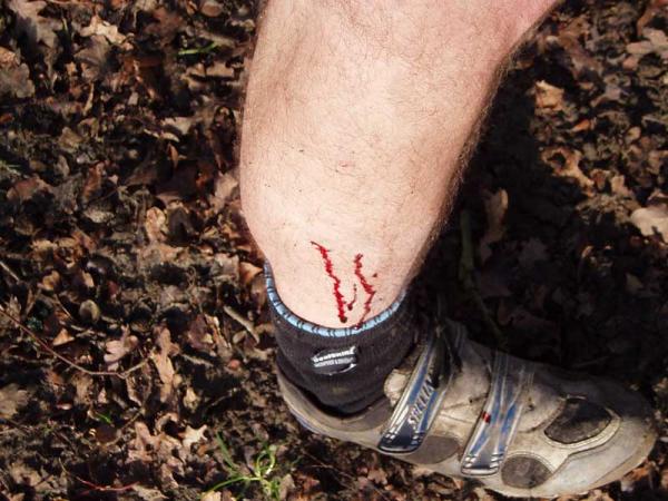 وفاة طفل لدغه ثعبان بضواحي شيشاوة