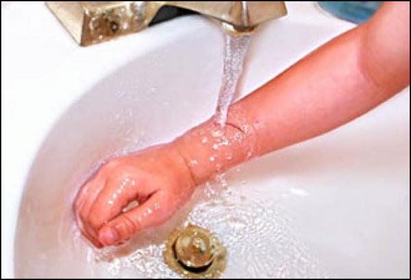 السيطرة على الجروح العميقة