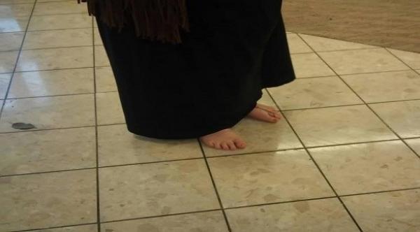 لماذا تمشي هذه المرأة حافية القدمين منذ 3 سنوات؟