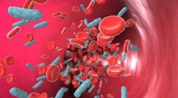 دراسة: تسمم الدم يصيب الأصحاء أيضاًً